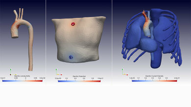 In den Simulationen lassen sich Änderungen in den elektrischen Feldern genau analysieren.