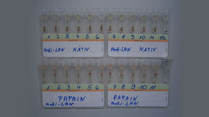 Labordiagnostik