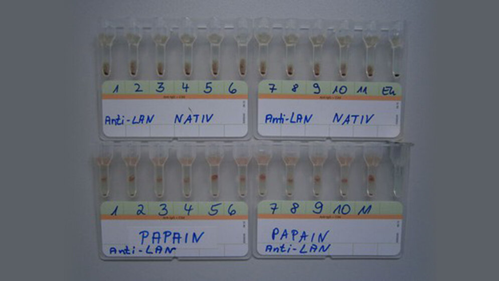 Labordiagnostik