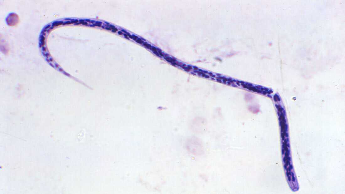 Bild einer Onchocerca volvulus Mikrofilarienlarve
