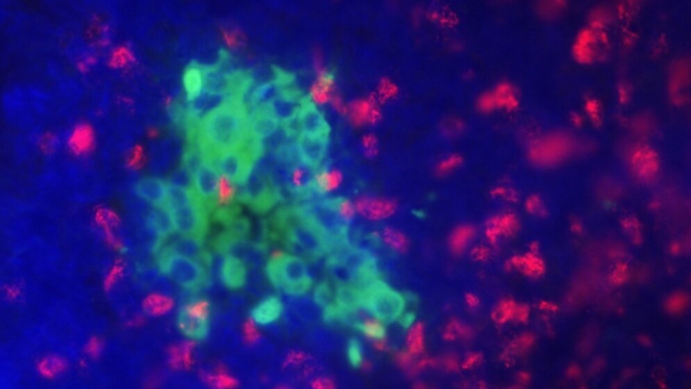 Optimierte Insulin-Bausteine 