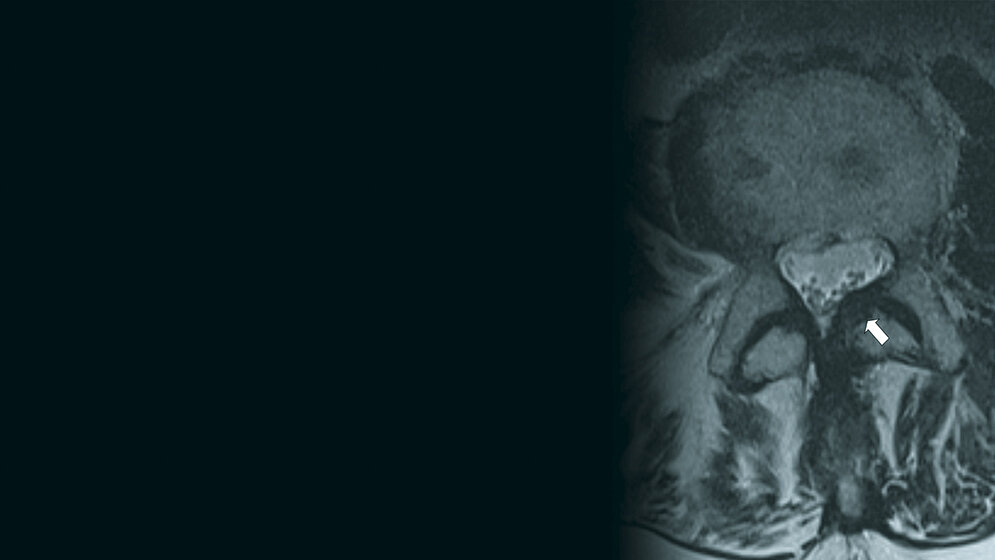 Ligamentäre Veränderungen