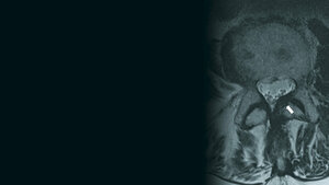 Ligamentäre Veränderungen