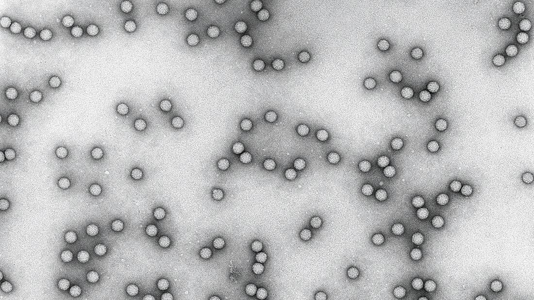 Poliomyelitis und krebserregende Viren Aufnahme von Polioviren unter dem Elektronenmikroskop