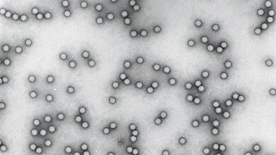 Aufnahme von Polioviren unter dem Elektronenmikroskop