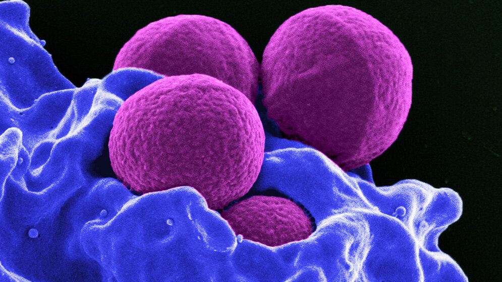 Staphylococcus_aureus_National_Institute_of_Allergy_and_Infectious_Diseases.jpg Staphylococcus aureus