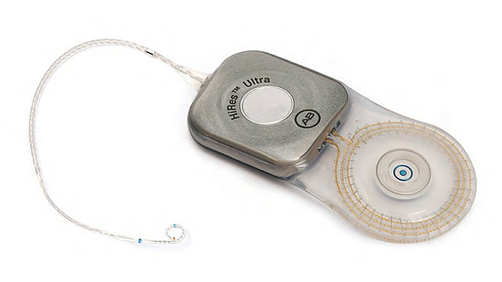 Cochlea-Implantate und MRT