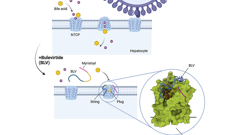 Hepatitis_B_und_D.jpg molekulare Blockade durch Bulevirtide