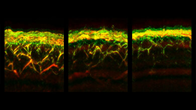 RSOM-Aufnahmen der Haut