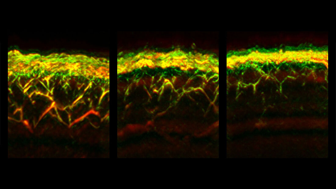 RSOM-Aufnahmen der Haut