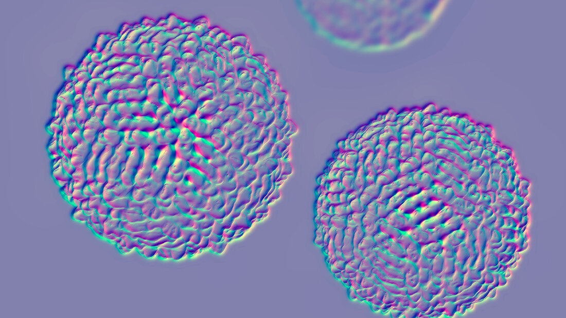 WNV_Adobe.jpg West-Nil-Virus