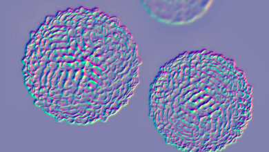 WNV_Adobe.jpg West-Nil-Virus