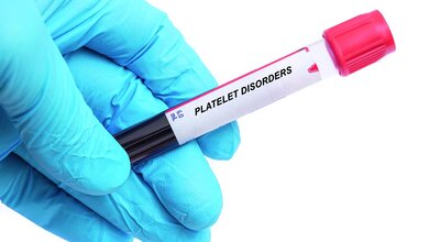 Foto eines Reagenzglases mit der Aufschrift „Platelet Disorders“
