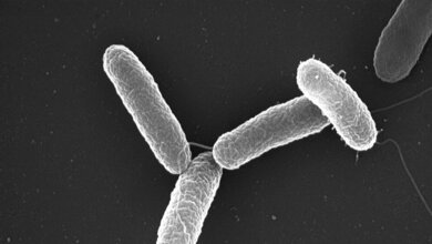 Salmonella_typhimurium_Volker_Brinkmann_MPI_for_Infection_Biology_DOI10.1371journal.pbio.0030166_CC_BY_2_5.jpg Salmonella typhimurium