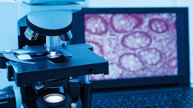 Laboraufnahme eines modernen Mikroskops mit Objektträger, dessen vergrößertes Gewebebild parallel auf einem Laptop-Bildschirm dargestellt wird.
