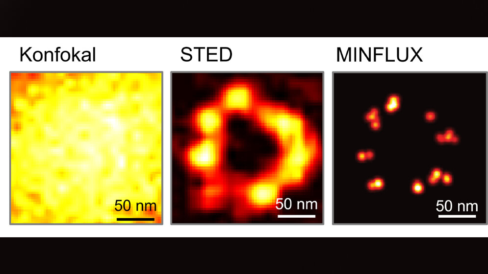 Aufloesungs_Durchbrueche_Stefan_Hell_Max_Planck_Institut_für_biophysikalische_Chemie.jpg Fluoreszenzmikroskopie