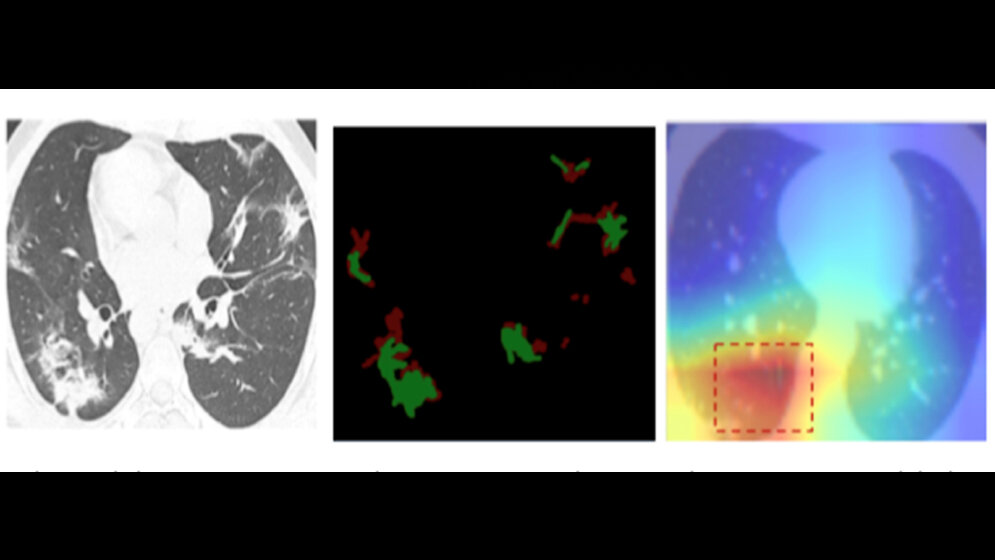 CT_Scans_DKFI.jpg Nutzung von CT-Scans