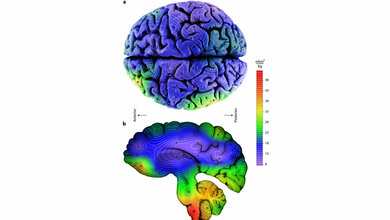 unterschiedliche Konzentrationen magnetischer Kristalle