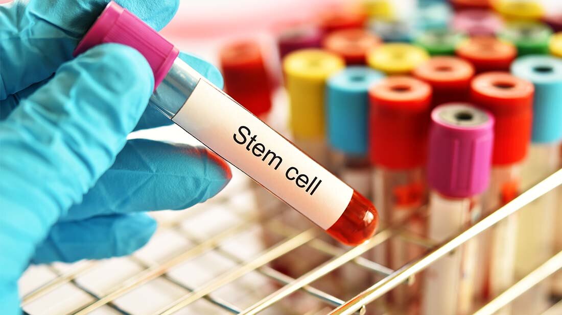 Stammzelltherapie_COVID-19.jpg Die Patient:innen infizierten sich erst relativ spät, in der 2. oder 3. Welle.