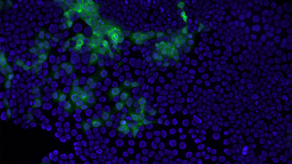 Gruene_Immunfaerbung_Hepatitis_E_Virus_Kapsidprotein_Leonard_Knegendorf_TWINCORE.jpg grüne Immunfärbung des Hepatitis E Virus Kapsidproteins