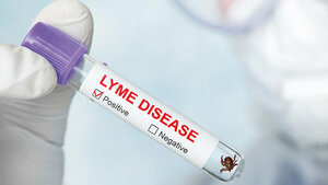 Title picture of the expert article with important facts on Lyme disease