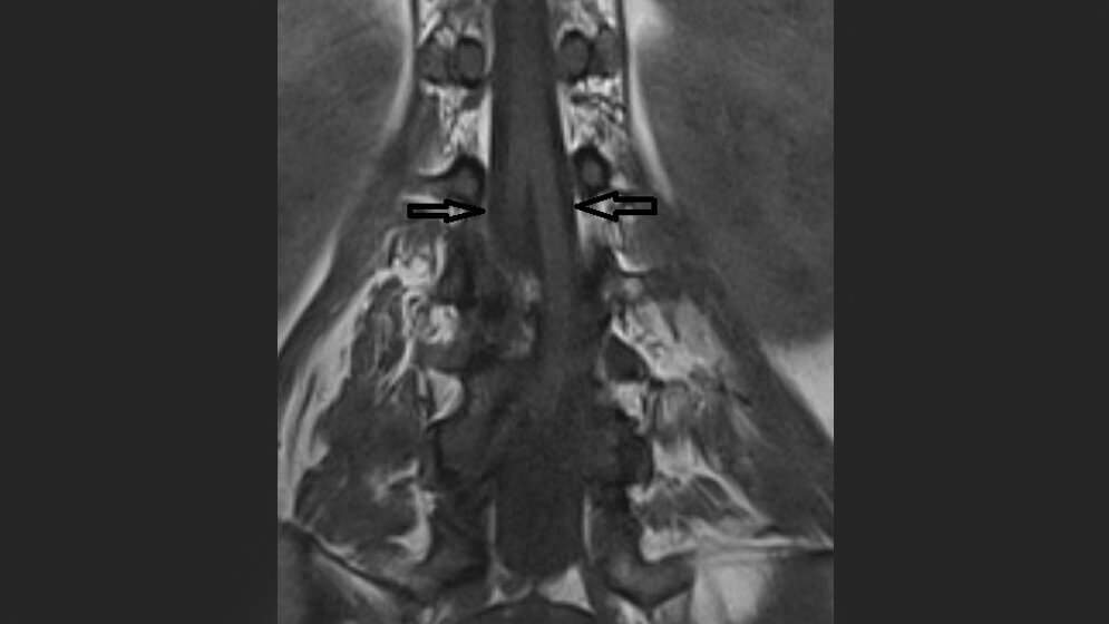 Anomalien und Normvarianten – Skelettale Veränderungen 3.18