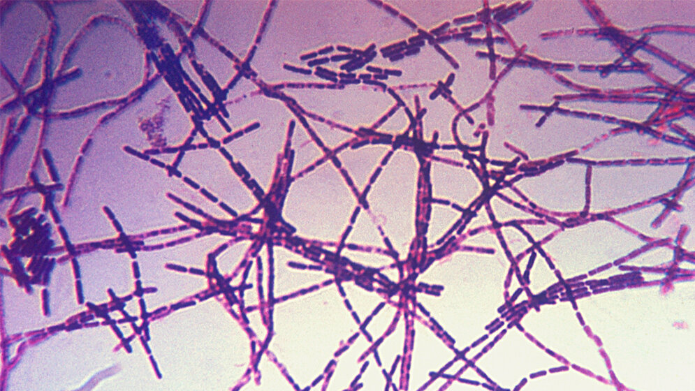 Bacillus anthracis