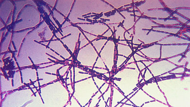 Bacillus anthracis