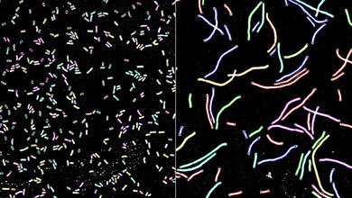 Regulation_Zellteilung_Klebsiella.jpg Klebsiella pneumoniae