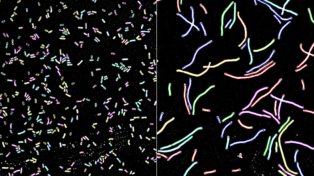 Klebsiella pneumoniae