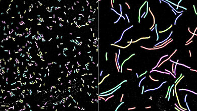 Klebsiella pneumoniae