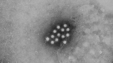 Virion des Hepatitis-A-Virus