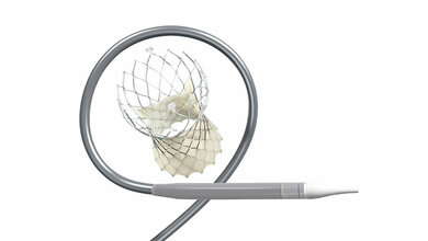 EVOLUT™ PRO+ TAVI-System