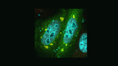 FUS-Protein 