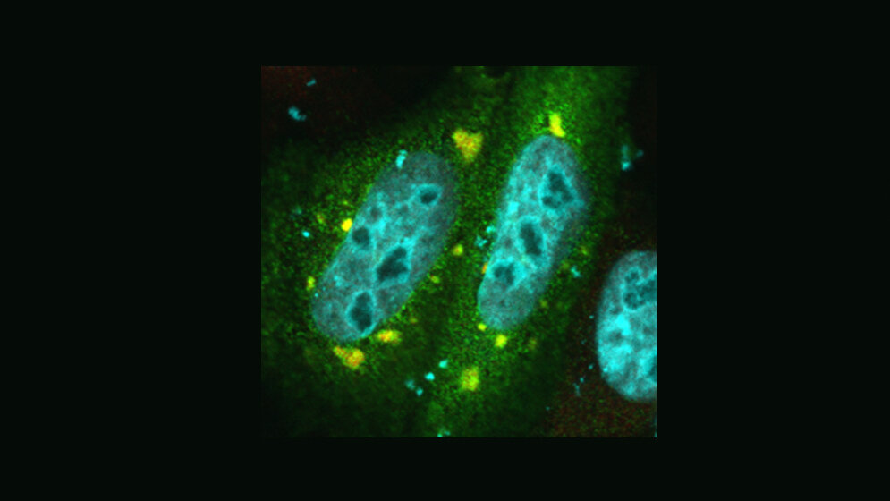 FUS-Protein 