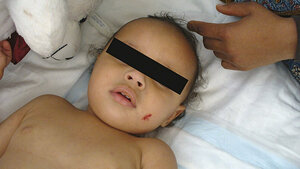 Infektionsmanagement