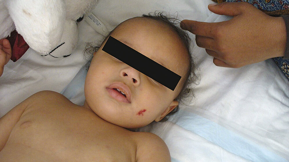 Infektionsmanagement