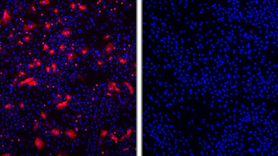 Hepatitis_D_Viren_rot_in_menschliche_Leberzellen_mit_Myrcludex_B_rechts_Uniklinikum_Heidelberg_Urban_18082016.jpg Kein Eintritt für Hepatitis-D-Viren