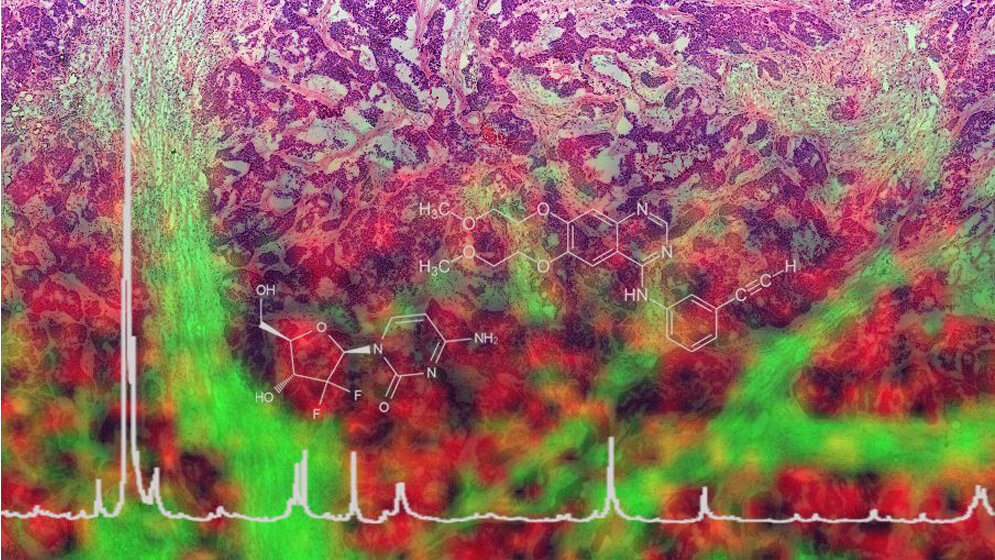 eine_Art_molekulare_Landkarte_erstellen_HZM.jpg molekulare Landkarte