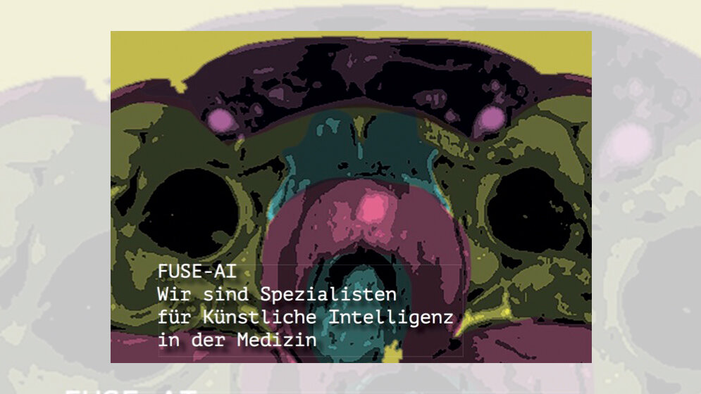 Prostatakarzinome sicherer erkennen