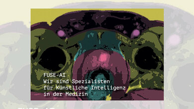 Prostatakarzinome sicherer erkennen