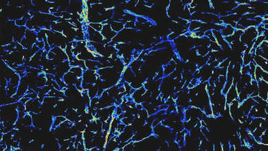 Netz_Blutgefaesse_in_wachsendem_Tumor_La_Porta_DKFZ.jpg Netz von Blutgefäßen