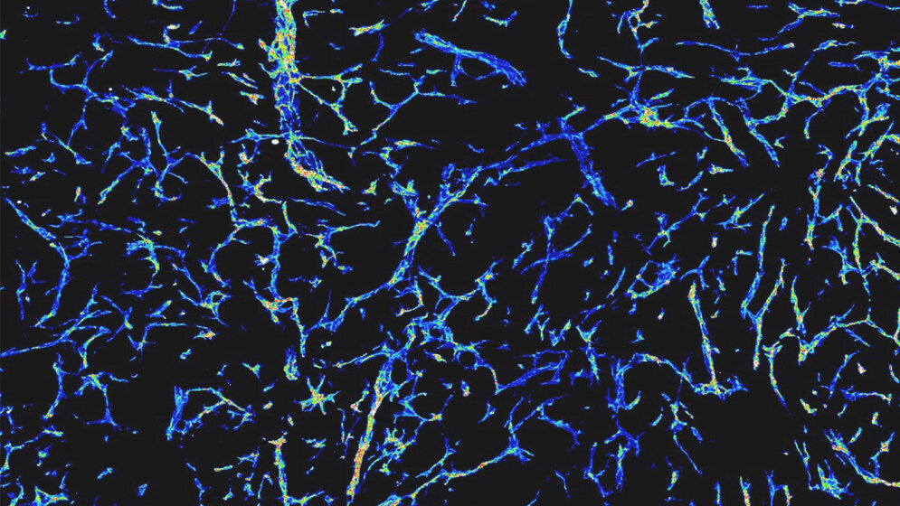 Netz_Blutgefaesse_in_wachsendem_Tumor_La_Porta_DKFZ.jpg Netz von Blutgefäßen