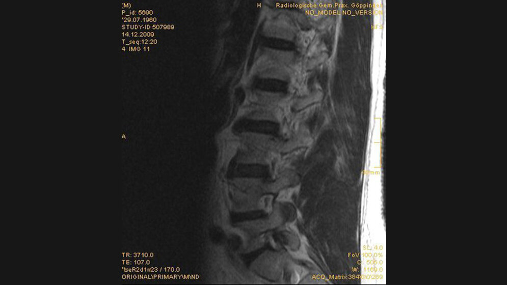 Zufallsbefunde: Abdominales Aortenaneurysma Bildgebende Verfahren