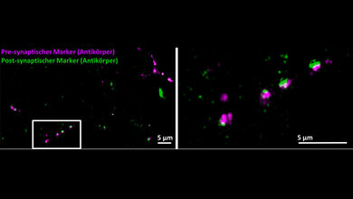 Gehirnzellen-Synapsen