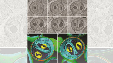 Kryo_elektronenmikroskopische_Aufnahmen_oben_und_3D_Rekonstruktion_unten_eines_Planctomyceten.jpg Kryo-elektronenmikroskopische Aufnahmen (oben) und 3D Rekonstruktion (unten) eines Planctomyceten