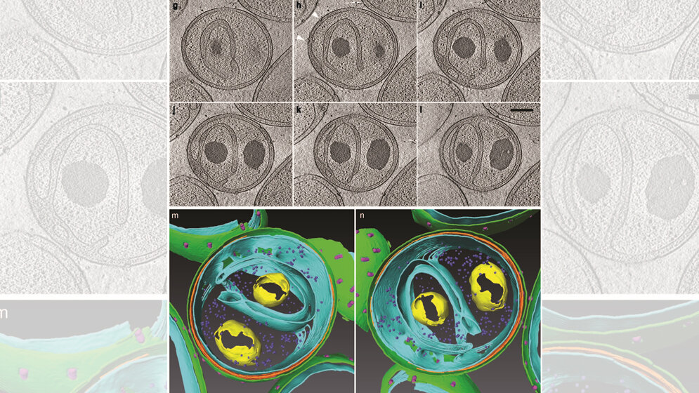 Kryo_elektronenmikroskopische_Aufnahmen_oben_und_3D_Rekonstruktion_unten_eines_Planctomyceten.jpg Kryo-elektronenmikroskopische Aufnahmen (oben) und 3D Rekonstruktion (unten) eines Planctomyceten