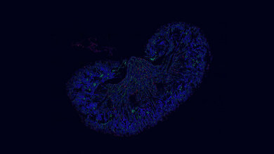 Makrophagen (rot) in der Niere einer neugeborenen Maus