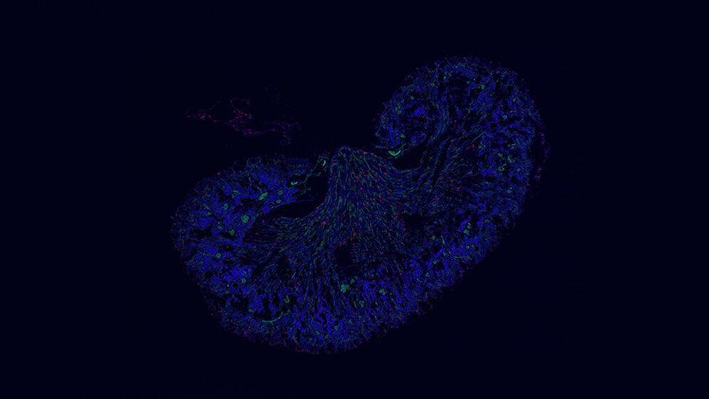 Makrophagen_rot_in_der_Niere_einer_neugeborenen_Maus_Bild_Stephan_Rambichler_Barbara_Schraml.jpg Makrophagen (rot) in der Niere einer neugeborenen Maus