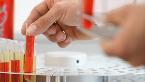 Food Analysis – Pathogenic Bacteria in Food